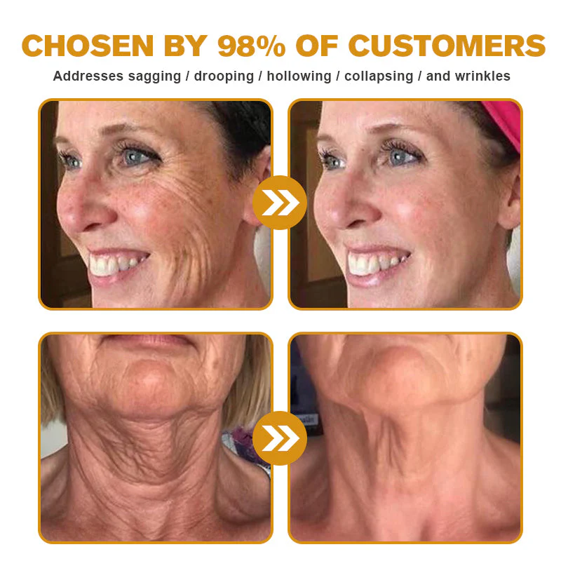 👨‍⚕️ Made and Shipped from US✅ Botox Bee Venom Wrinkle Removal Cream- LAST DAY 80% OFF