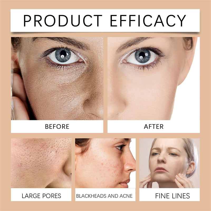 🔥Last Day 49% OFF- Herbal Spots PeelOff Facial Mask