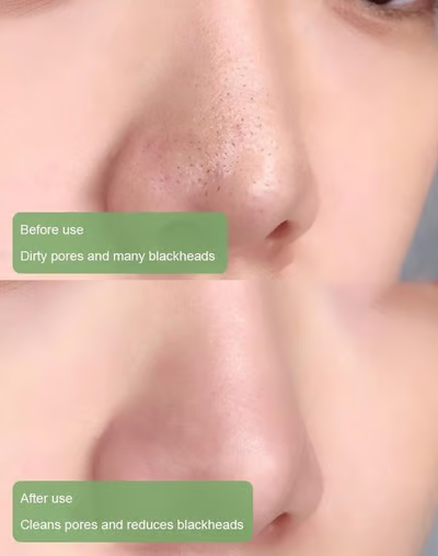 🍵 Deep Cleanse Green Tea Mask